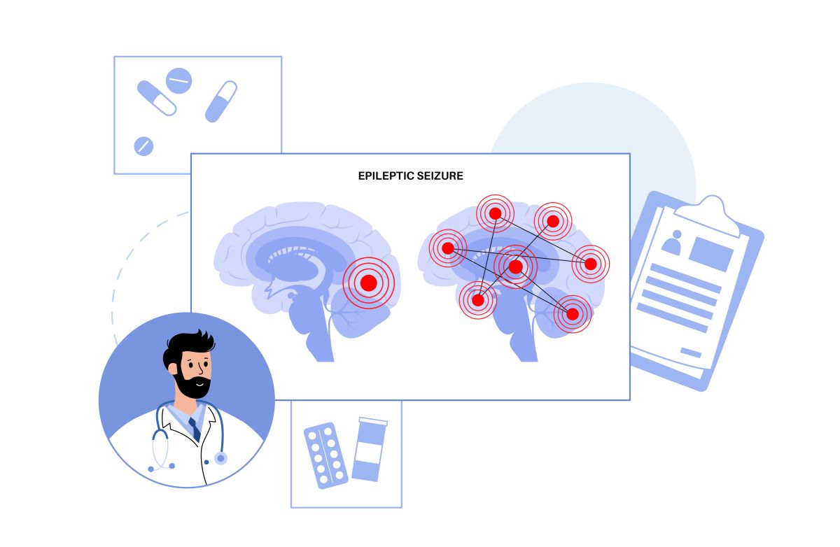 Epilepsies : maladies variées, hétérogènes et fréquentes 